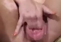 anal gaping hole