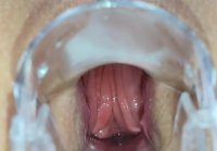 Beautiful view of my anal hole with speculum