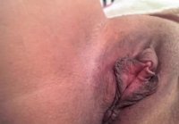 anal gaping hole