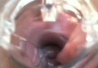 Inserted a speculum in the pussy and gives a gynecology lesson