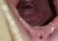 anal gaping hole