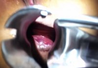 mouth gaping