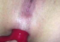 Anal destruction with prolapse   Loose and on the run