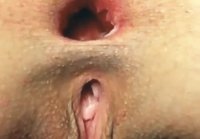 gaping hole