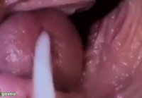 The camera inside the vagina captured how the member cums