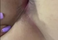 Showed the anal hole close up