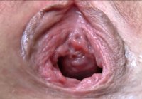 gaping hole